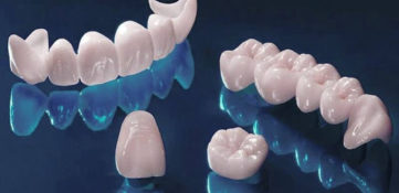 Metal-free ceramic crown