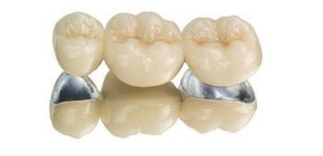 Ceramic-metal crown